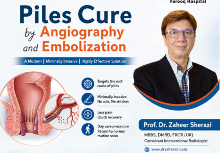 Piles Cure by Angiography and Embolization