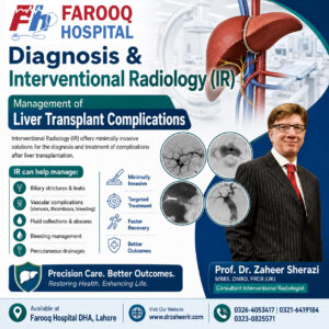 Diagnosis & Interventional Radiology (IR) Management of Liver Transplant Complications