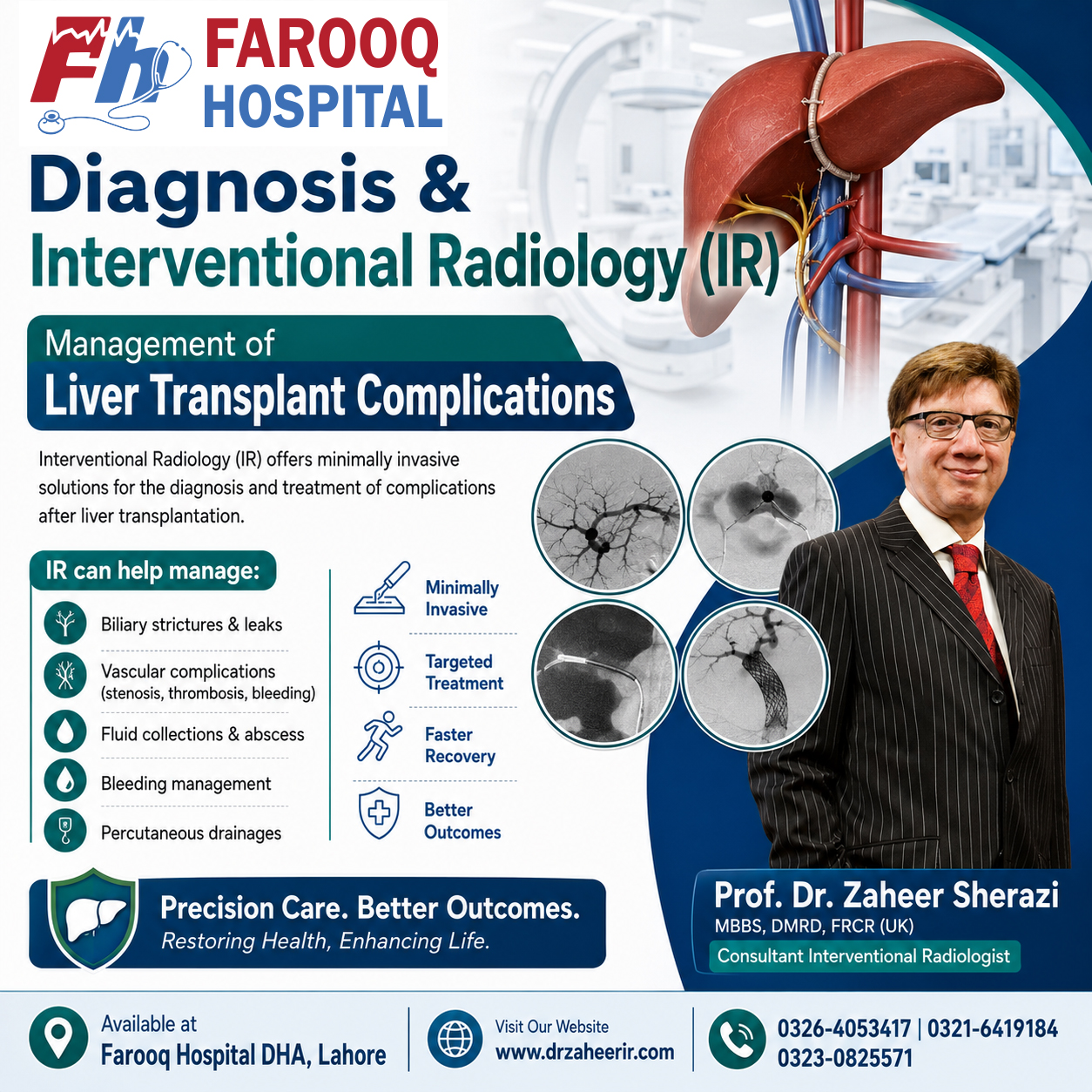 Diagnosis & Interventional Radiology (IR) Management of Liver Transplant Complications - Consultant Interventional Radiologist - Prof. Dr. Zaheer Sherazi