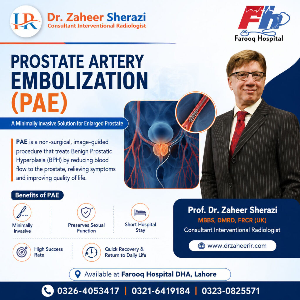 Prostate Artery Embolization (PAE)