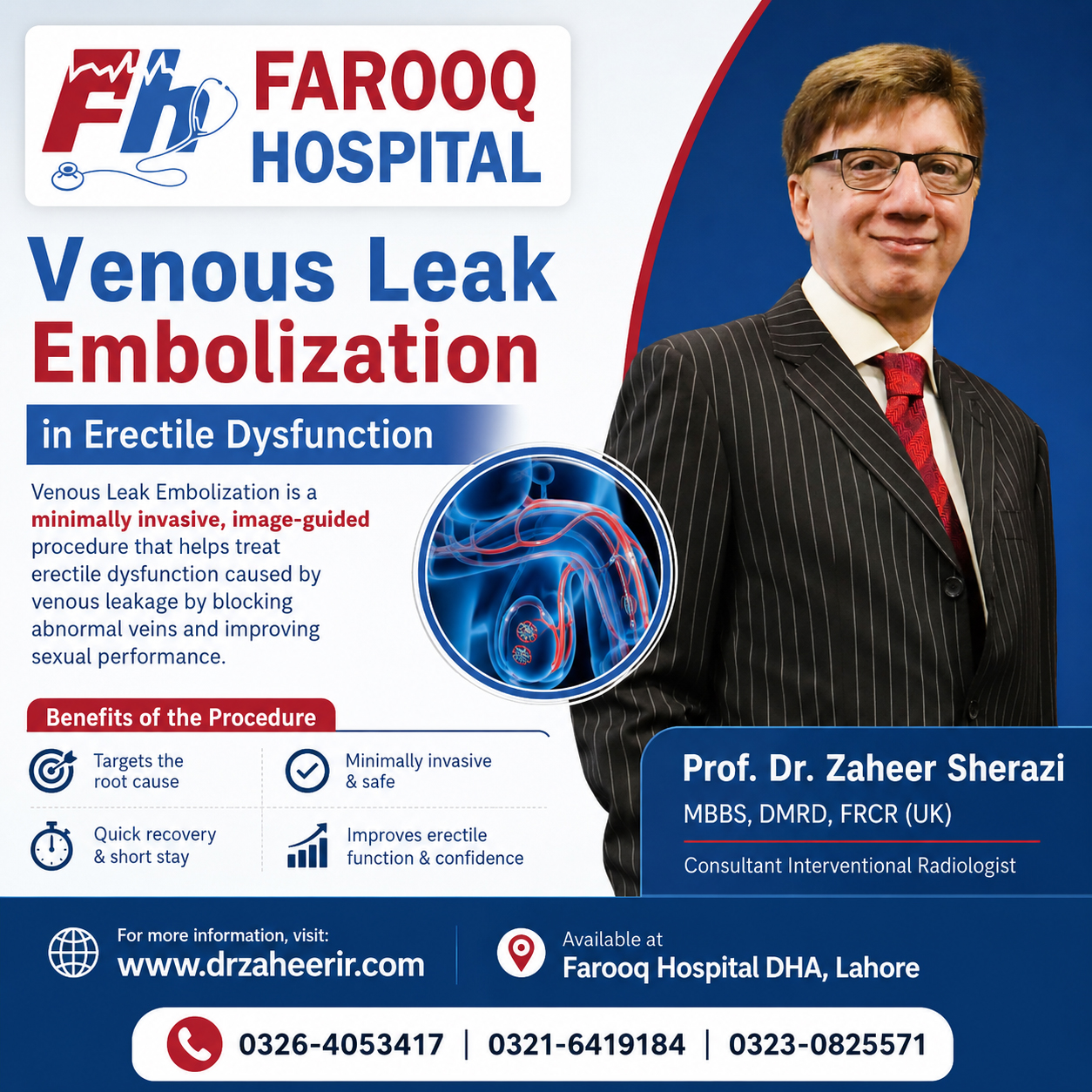 Venous Leak Embolization in Erectile Dysfunction- professor dr zaheer sherazi - consultant interventional radiologist