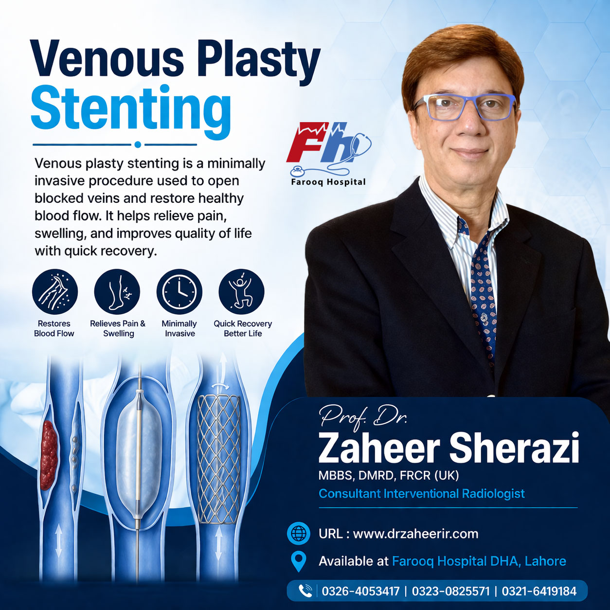 Venous Plasty Stenting - Dr Zhaeer Sherazi - Farooq Hospital DHA Lahore