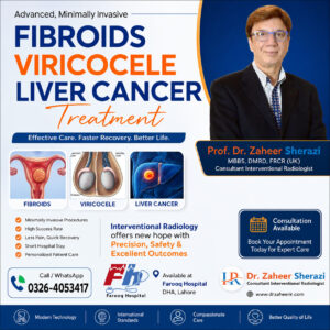 Fibroids VIRICOCELE Liver Cancer Treatment