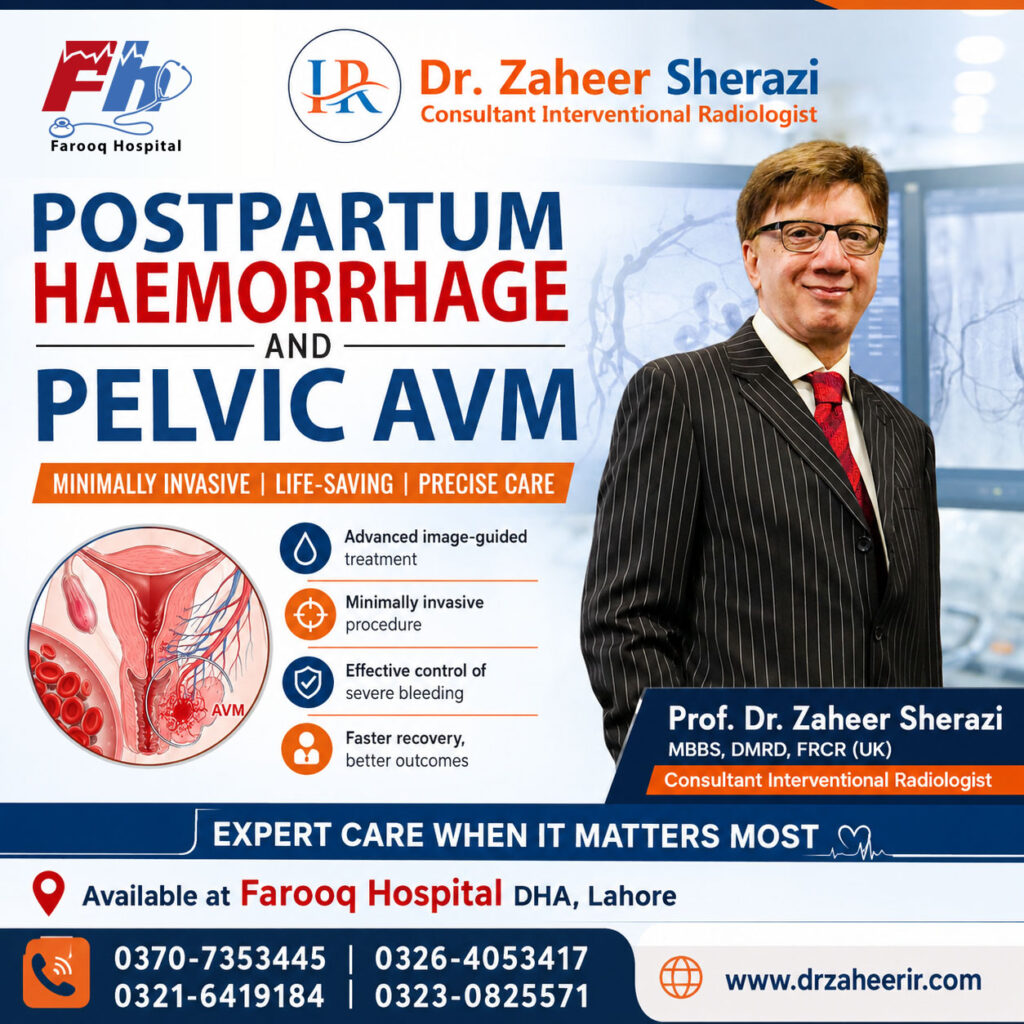 Postpartum Haemorrhage and Pelvic AVM